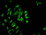 H3K9me2 Antibody in Immunocytochemistry (ICC/IF)