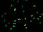 H3K23ac Antibody in Immunocytochemistry (ICC/IF)