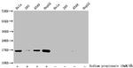 H3K23pr Antibody in Western Blot (WB)