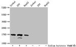 H3K36ac Antibody in Western Blot (WB)