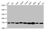 H3K4me3 Antibody in Western Blot (WB)