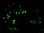 H3K9me2 Antibody in Immunocytochemistry (ICC/IF)