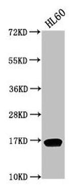 H3K9me2 Antibody in Western Blot (WB)