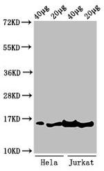 H3K36me3 Antibody in Western Blot (WB)