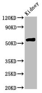 HMGCS2 Antibody in Western Blot (WB)