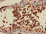 AMPK gamma-1 Antibody in Immunohistochemistry (Paraffin) (IHC (P))