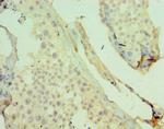 JMJD2B Antibody in Immunohistochemistry (Paraffin) (IHC (P))