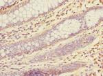 KHK Antibody in Immunohistochemistry (Paraffin) (IHC (P))