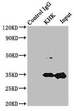 KHK Antibody in Immunoprecipitation (IP)