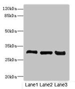 KHK Antibody in Western Blot (WB)