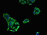 KIR3DL1 Antibody in Immunocytochemistry (ICC/IF)