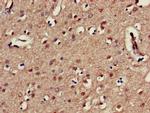 KIR3DL1 Antibody in Immunohistochemistry (Paraffin) (IHC (P))