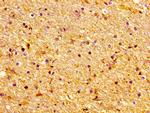 Lass1 Antibody in Immunohistochemistry (Paraffin) (IHC (P))