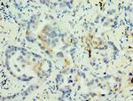 MAGEA6 Antibody in Immunohistochemistry (Paraffin) (IHC (P))