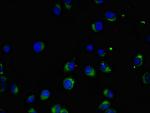 MAK Antibody in Immunocytochemistry (ICC/IF)