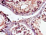 MAK Antibody in Immunohistochemistry (Paraffin) (IHC (P))