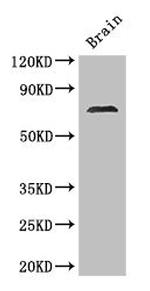 MAK Antibody in Western Blot (WB)