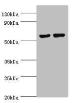 MATN3 Antibody in Western Blot (WB)