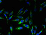 MPV17 Antibody in Immunocytochemistry (ICC/IF)