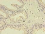 MTHFR Antibody in Immunohistochemistry (Paraffin) (IHC (P))