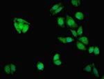 MTX2 Antibody in Immunocytochemistry (ICC/IF)