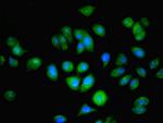 NAT2 Antibody in Immunocytochemistry (ICC/IF)