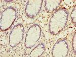 NAT2 Antibody in Immunohistochemistry (Paraffin) (IHC (P))