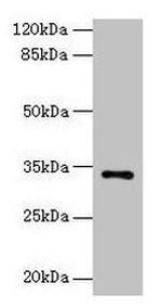 NAT2 Antibody in Western Blot (WB)