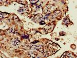 OBSL1 Antibody in Immunohistochemistry (Paraffin) (IHC (P))