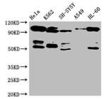 OFD1 Antibody in Western Blot (WB)