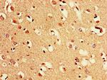 PAK3 Antibody in Immunohistochemistry (Paraffin) (IHC (P))