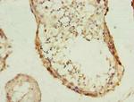 PHF10 Antibody in Immunohistochemistry (Paraffin) (IHC (P))