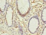 PHF10 Antibody in Immunohistochemistry (Paraffin) (IHC (P))