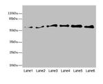 PIP5K1B Antibody in Western Blot (WB)