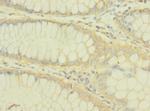 PLXNB2 Antibody in Immunohistochemistry (Paraffin) (IHC (P))