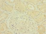 PLXNB2 Antibody in Immunohistochemistry (Paraffin) (IHC (P))