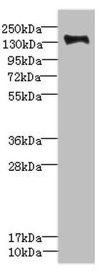 PLXNB2 Antibody in Western Blot (WB)