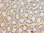 POP7 Antibody in Immunohistochemistry (Paraffin) (IHC (P))