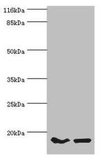 POP7 Antibody in Western Blot (WB)