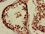 PPOX Antibody in Immunohistochemistry (Paraffin) (IHC (P))