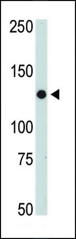 JAK2 Antibody in Western Blot (WB)