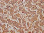 PRG2 Antibody in Immunohistochemistry (Paraffin) (IHC (P))