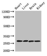 Trypsin 2 Antibody in Western Blot (WB)