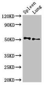 PSEN2 Antibody in Western Blot (WB)