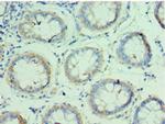 QARS Antibody in Immunohistochemistry (Paraffin) (IHC (P))