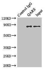 QARS Antibody in Immunoprecipitation (IP)