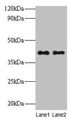 QPCT Antibody in Western Blot (WB)