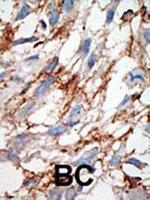 ISG15 Antibody in Immunohistochemistry (Paraffin) (IHC (P))