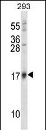 ISG15 Antibody in Western Blot (WB)