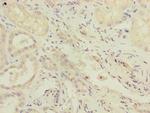 RAB4B Antibody in Immunohistochemistry (Paraffin) (IHC (P))